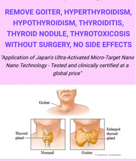 Thyroïde Mana - Nano Curcumine